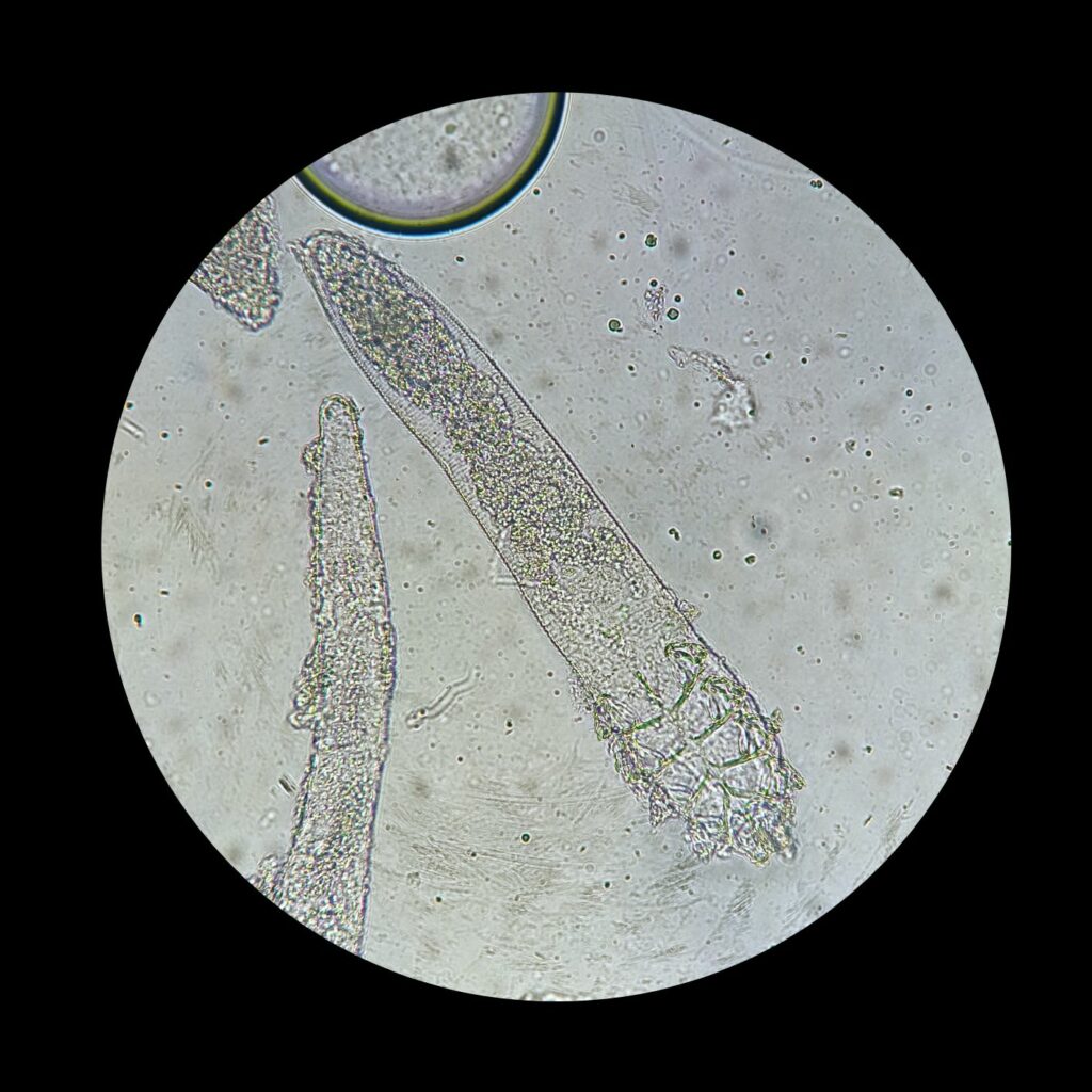 Demodexmilbe unter dem Mikroskop
