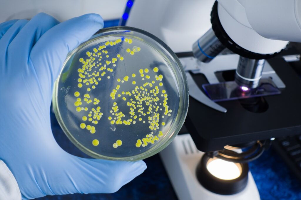Bakterien Bauchwassersucht Labor